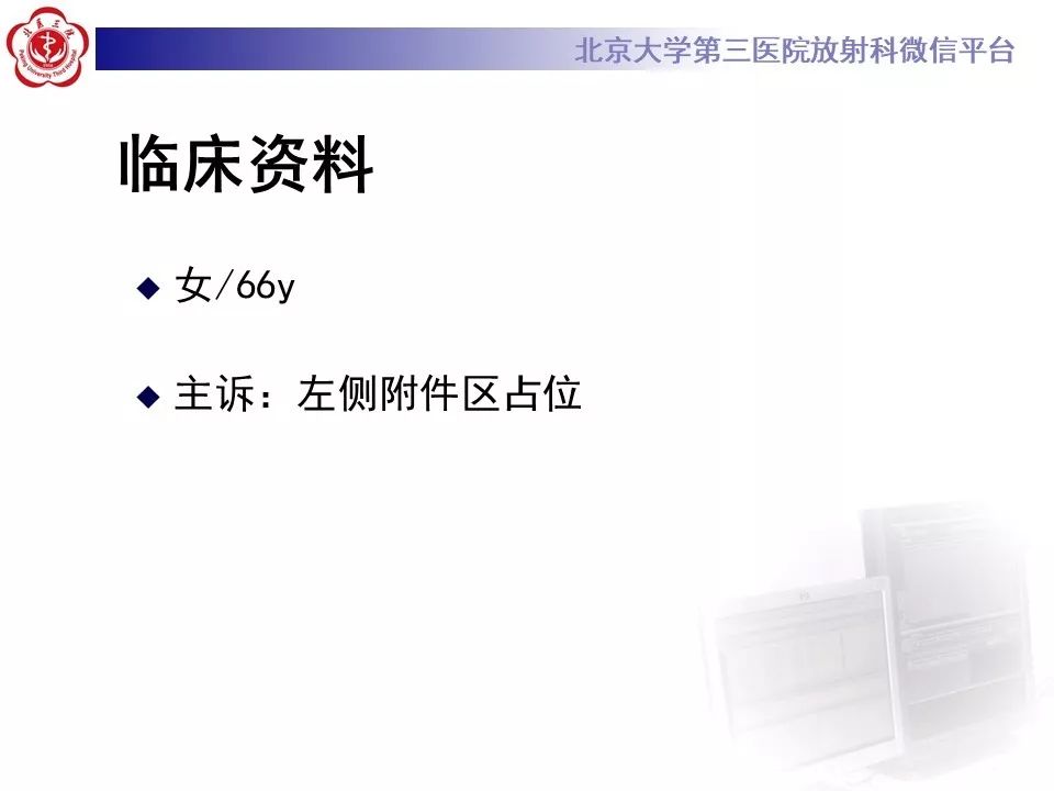 【PPT】卵巢甲状腺肿的影像