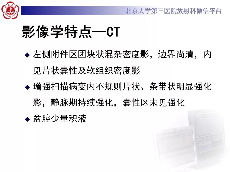【PPT】卵巢甲状腺肿的影像