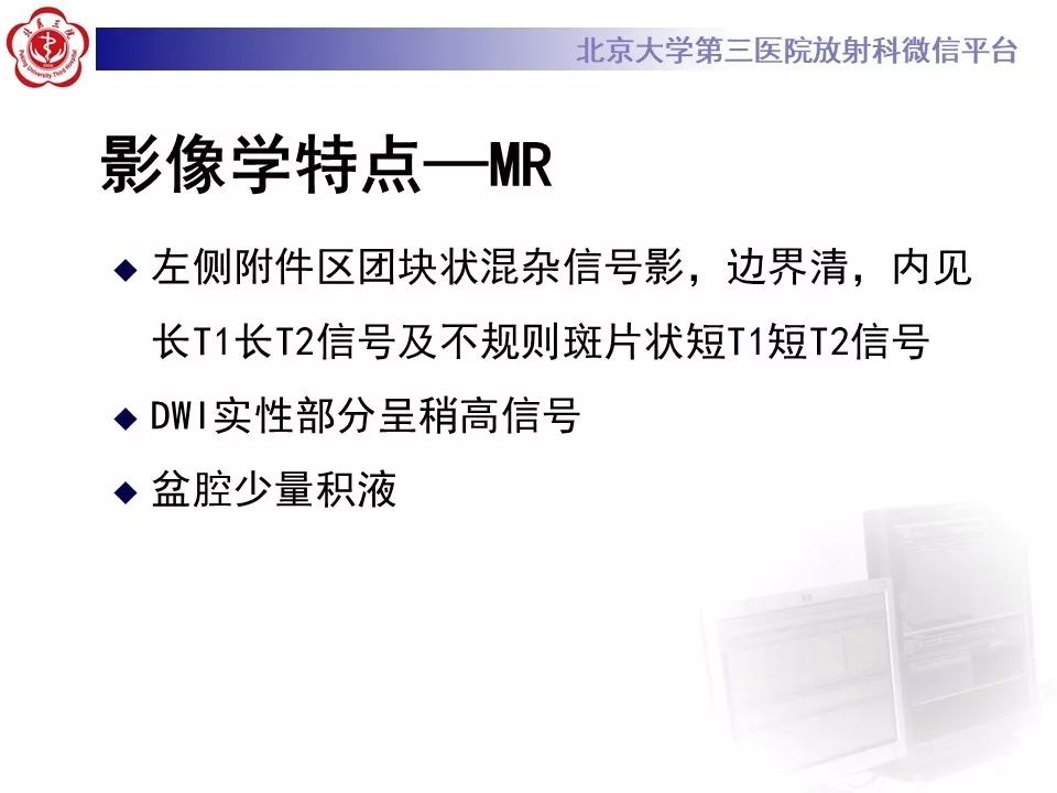 【PPT】卵巢甲状腺肿的影像