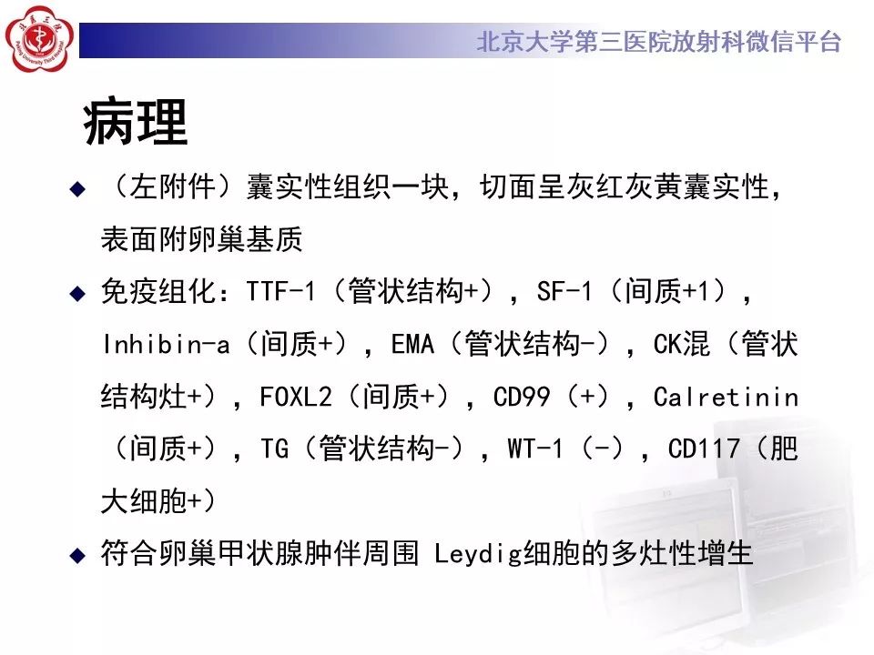 【PPT】卵巢甲状腺肿的影像