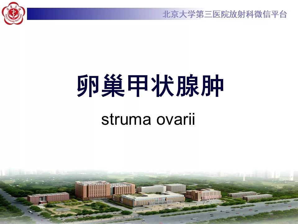 【PPT】卵巢甲状腺肿的影像
