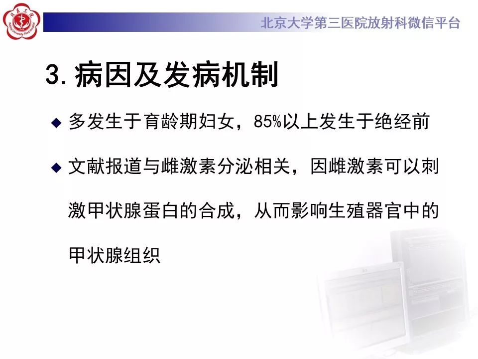 【PPT】卵巢甲状腺肿的影像