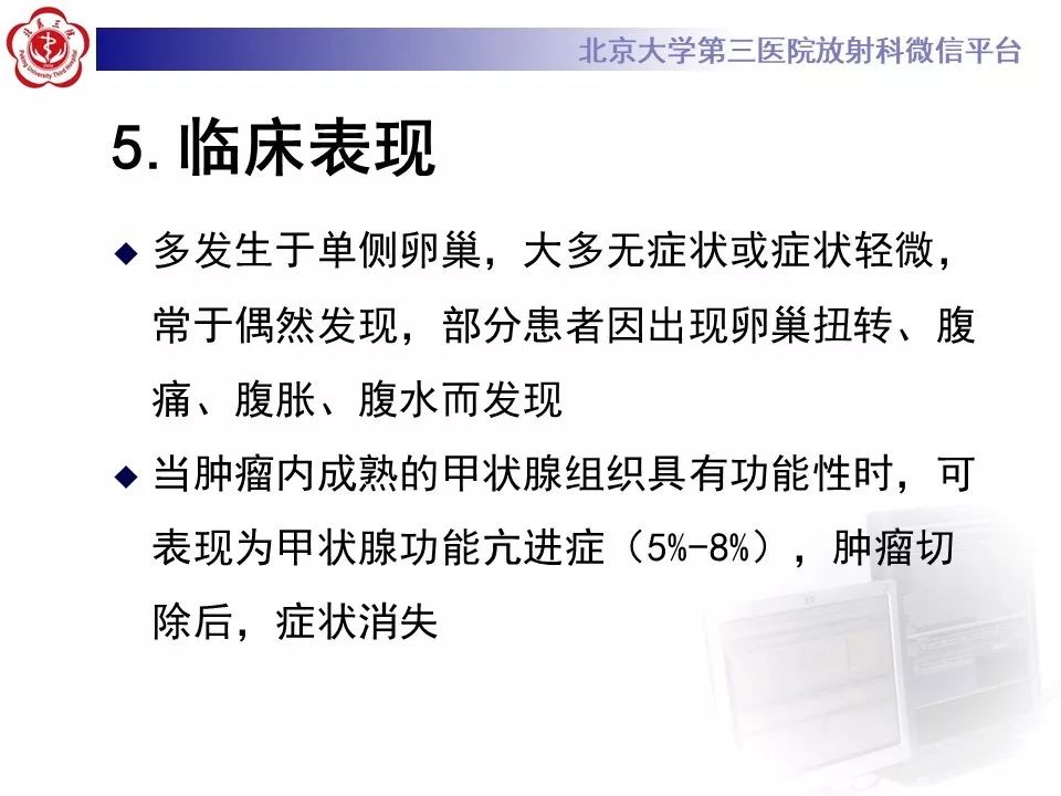 【PPT】卵巢甲状腺肿的影像