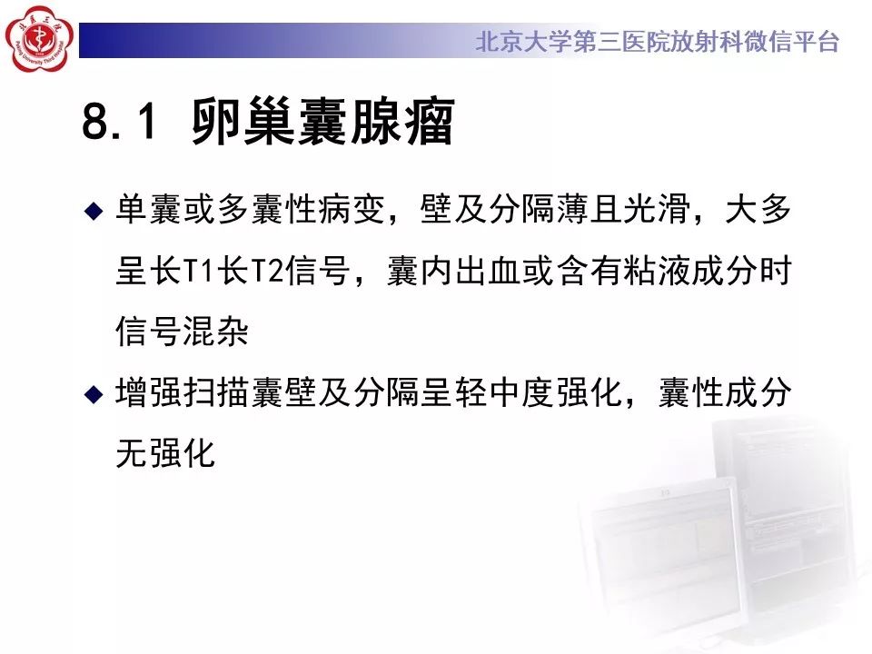 【PPT】卵巢甲状腺肿的影像