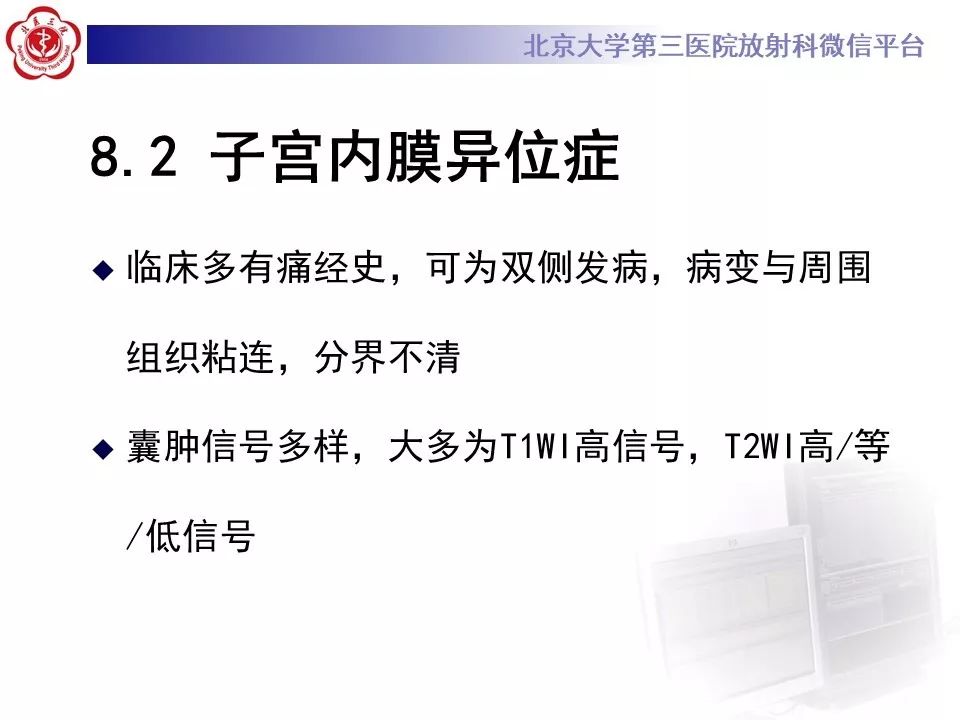 【PPT】卵巢甲状腺肿的影像