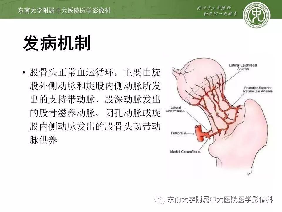 【PPT】股骨头缺血性坏死的影像