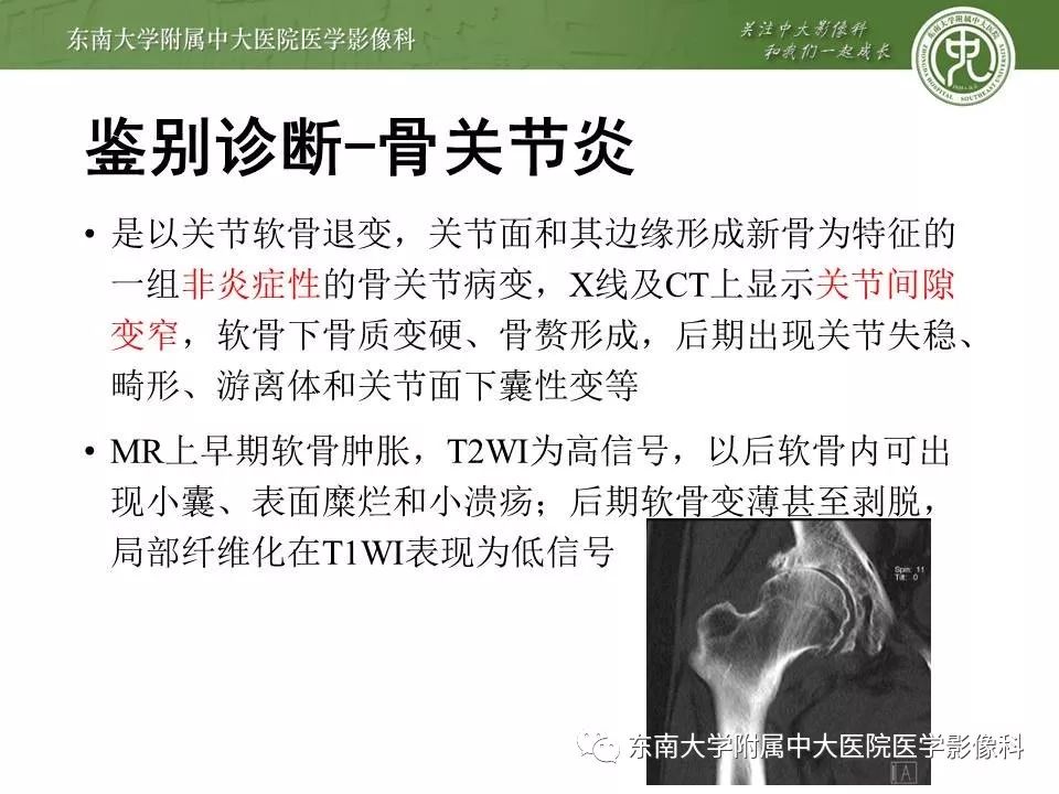 【PPT】股骨头缺血性坏死的影像