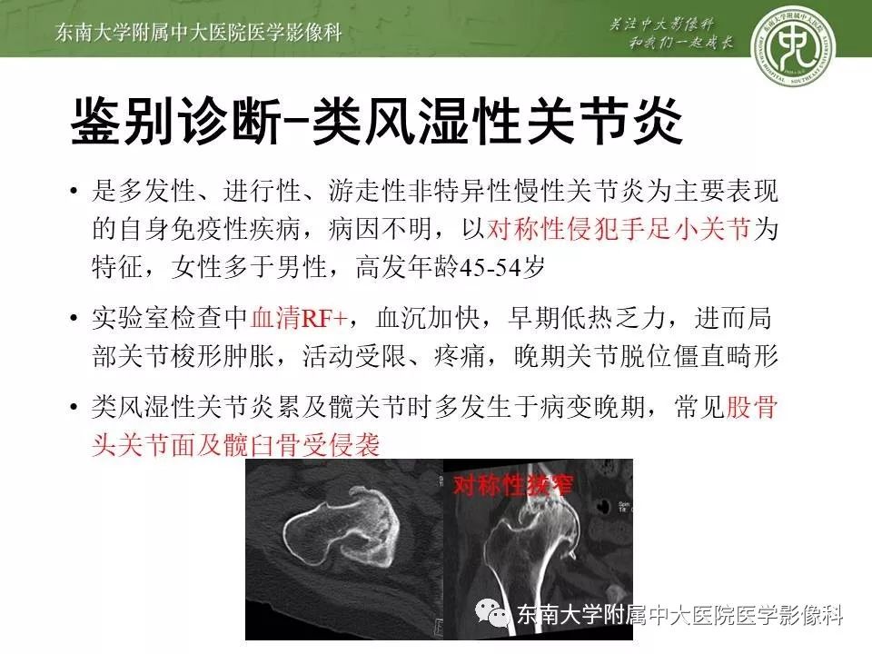 【PPT】股骨头缺血性坏死的影像