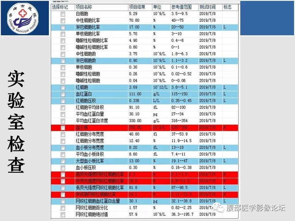 【病例】肾脏原始神经外胚层肿瘤PNET一例CT影像
