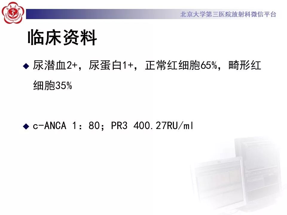 【PPT】肉芽肿性多血管炎/韦格纳肉芽的影像