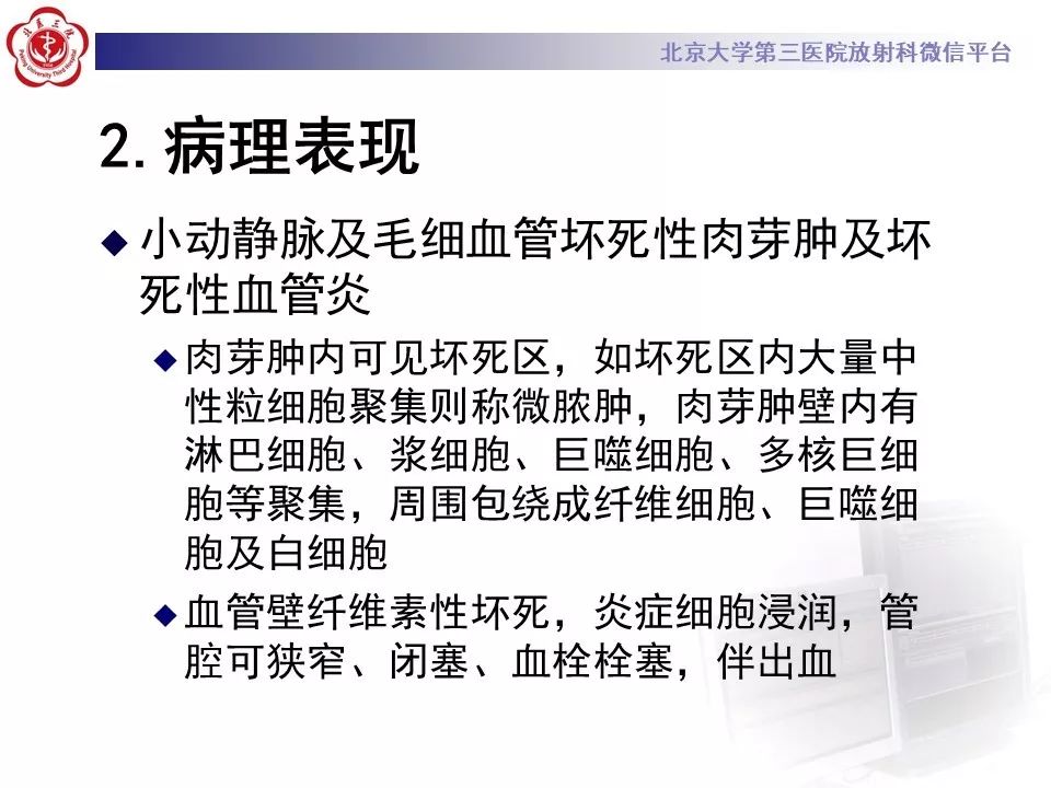 【PPT】肉芽肿性多血管炎/韦格纳肉芽的影像