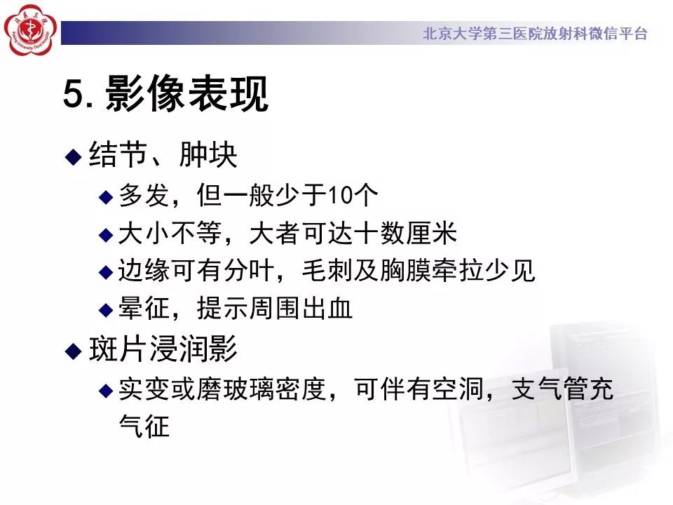 【PPT】肉芽肿性多血管炎/韦格纳肉芽的影像