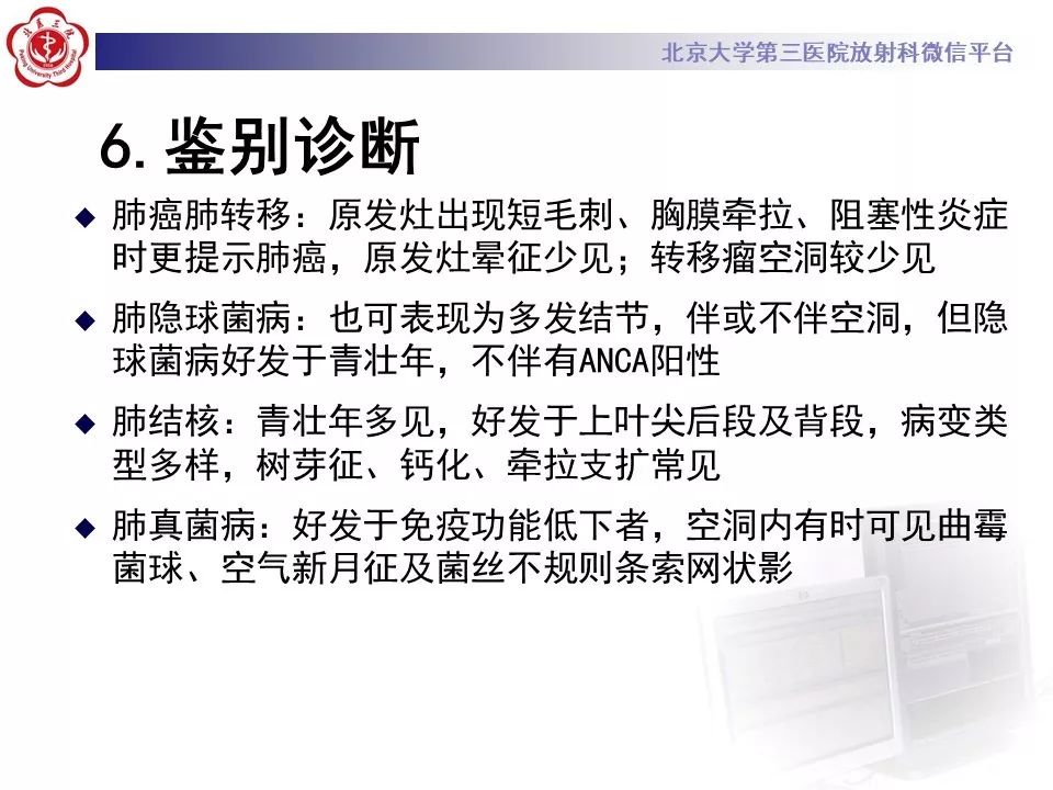【PPT】肉芽肿性多血管炎/韦格纳肉芽的影像