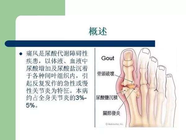 【PPT】痛风的影像表现