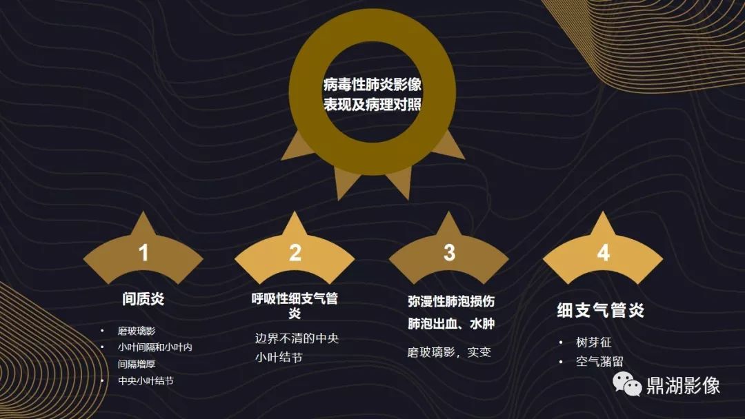 【PPT】病毒性肺炎的相关知识学习
