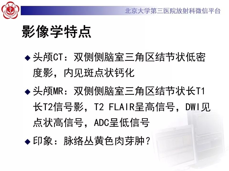 【PPT】脉络丛黄色肉芽肿的影像