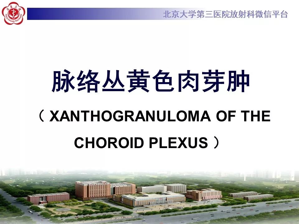 【PPT】脉络丛黄色肉芽肿的影像