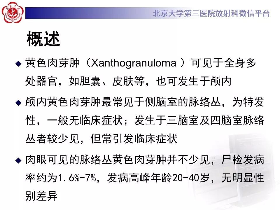 【PPT】脉络丛黄色肉芽肿的影像