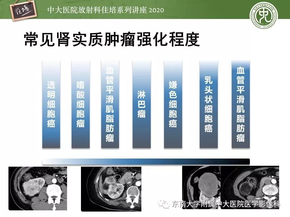 【PPT】肾脏乏血供占位的影像学诊断