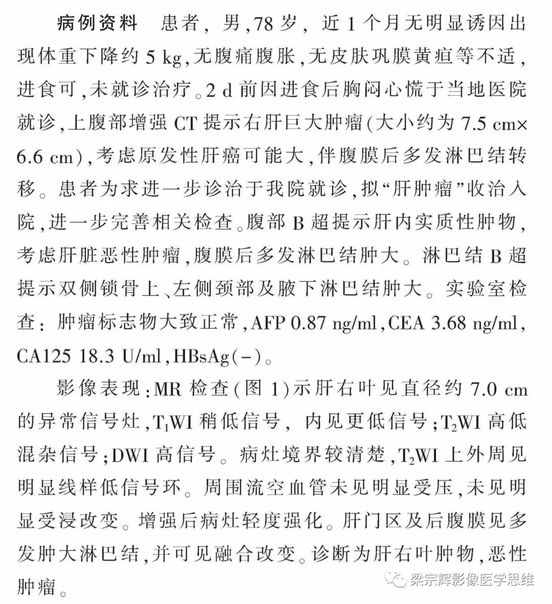 【病例】肝淋巴瘤1例影像诊断思维