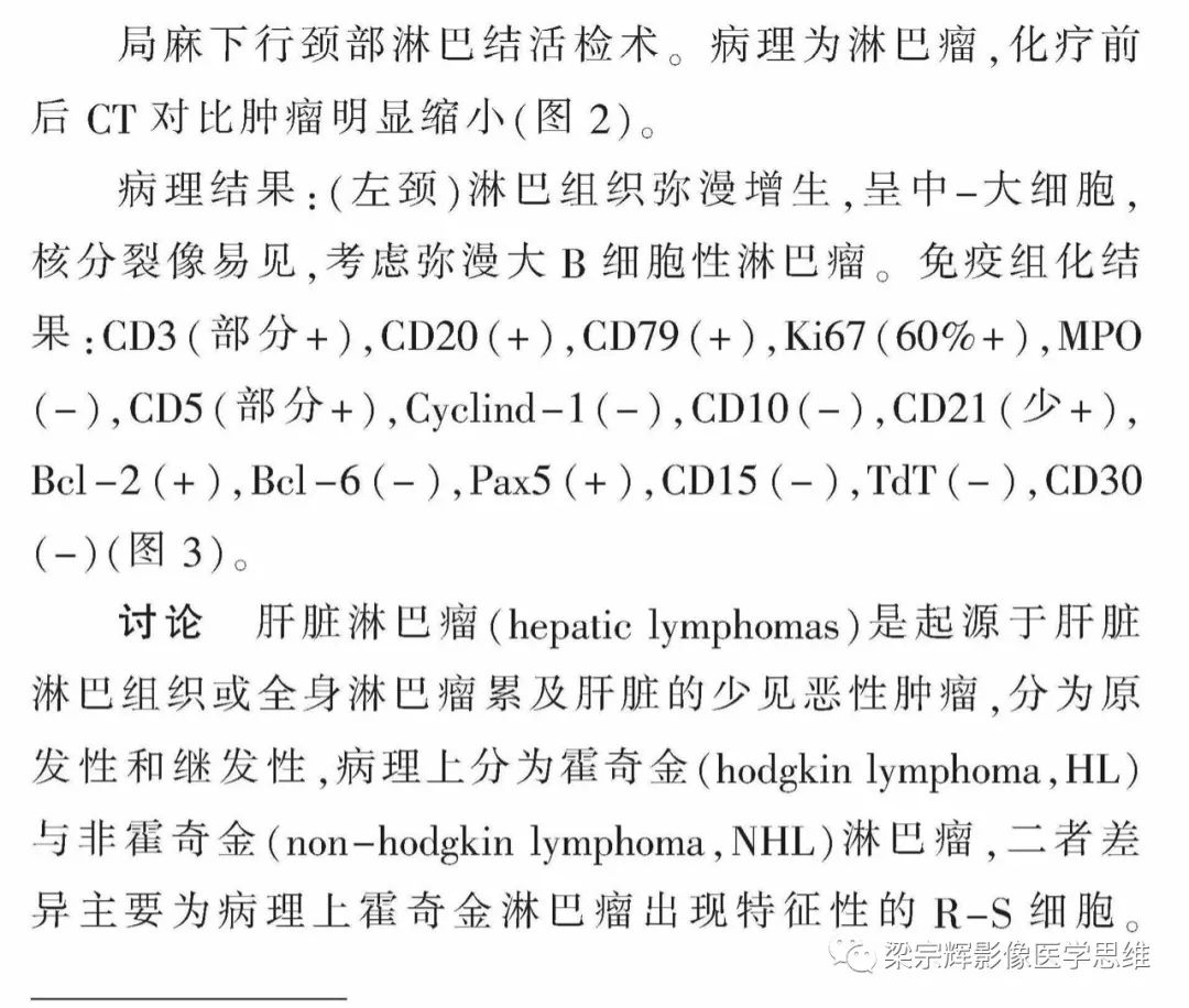 【病例】肝淋巴瘤1例影像诊断思维