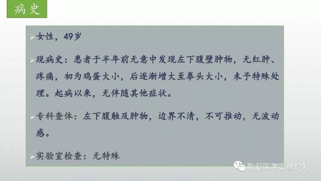 【病例】左下腹壁未分化多形性肉瘤1例CT影像