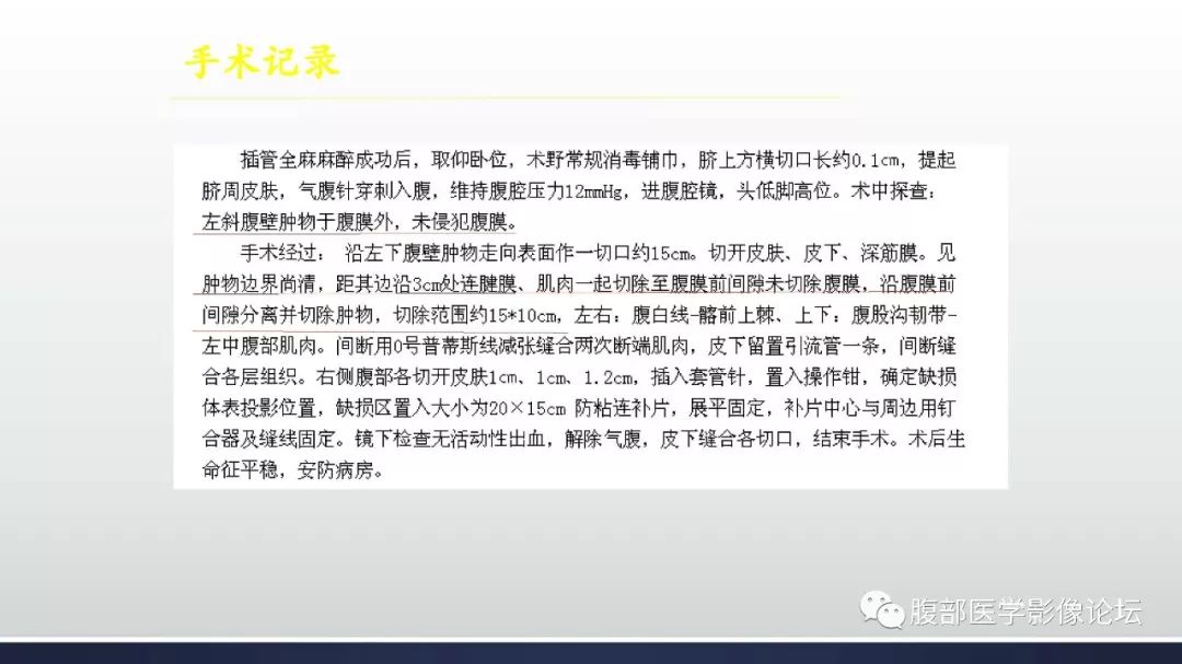 【病例】左下腹壁未分化多形性肉瘤1例CT影像