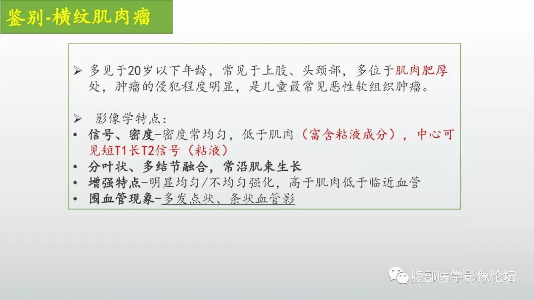 【病例】左下腹壁未分化多形性肉瘤1例CT影像