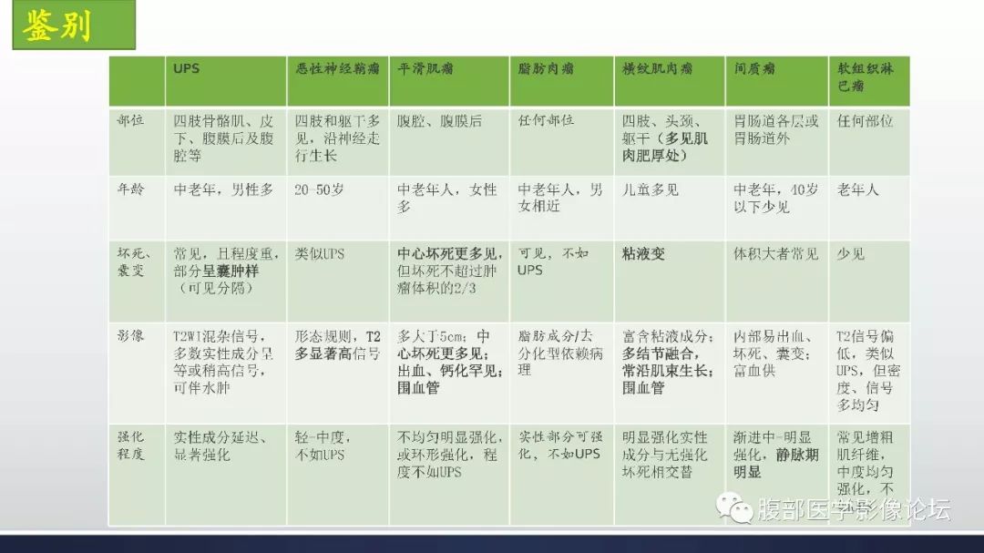 【病例】左下腹壁未分化多形性肉瘤1例CT影像