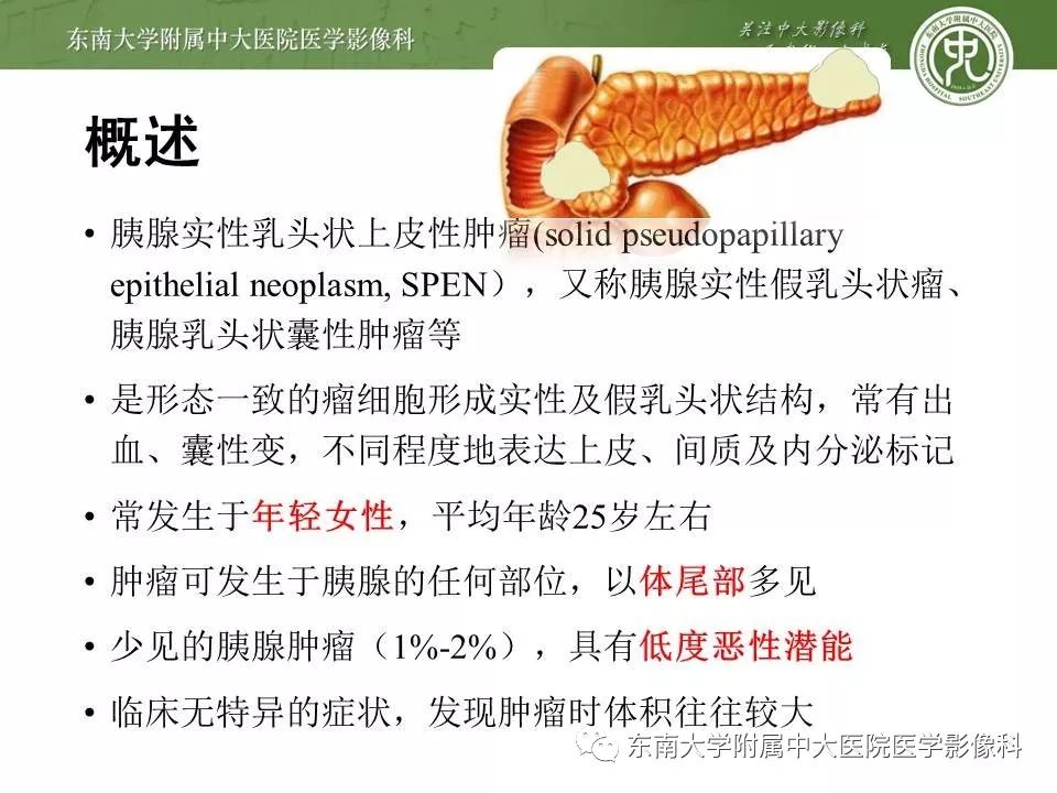 【PPT】胰腺实性乳头状上皮性肿瘤的影像