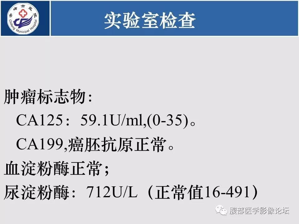 【病例】胃壁低度恶性纤维黏液样肉瘤1例CT影像