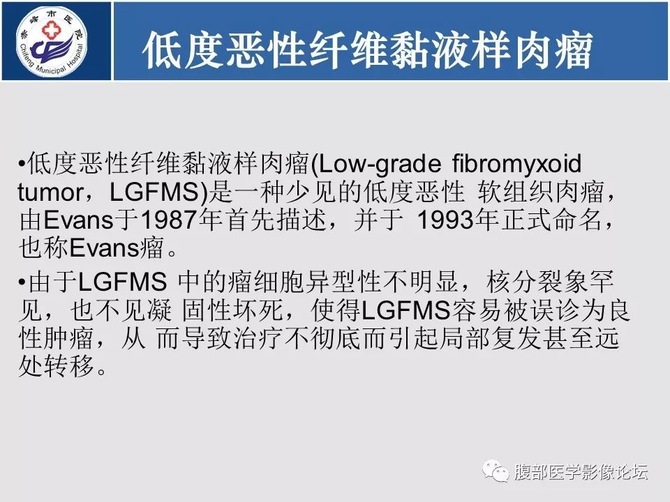 【病例】胃壁低度恶性纤维黏液样肉瘤1例CT影像