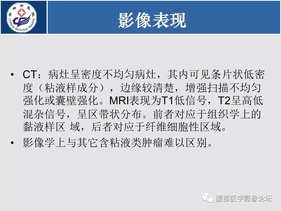 【病例】胃壁低度恶性纤维黏液样肉瘤1例CT影像