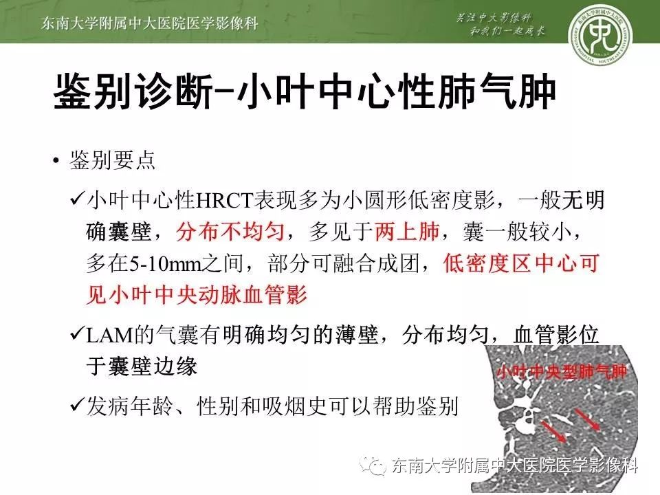 【PPT】肺淋巴管肌瘤病的影像