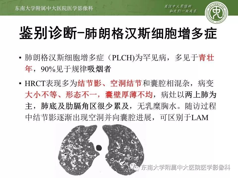 【PPT】肺淋巴管肌瘤病的影像