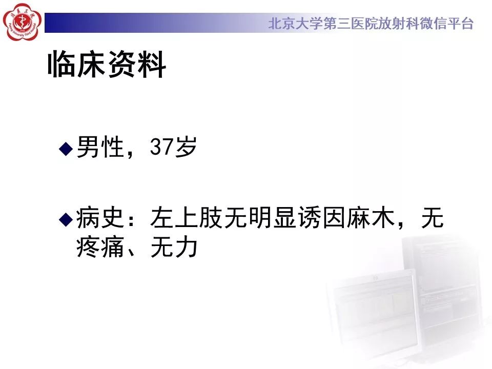 【PPT】椎管内海绵状血管瘤的影像