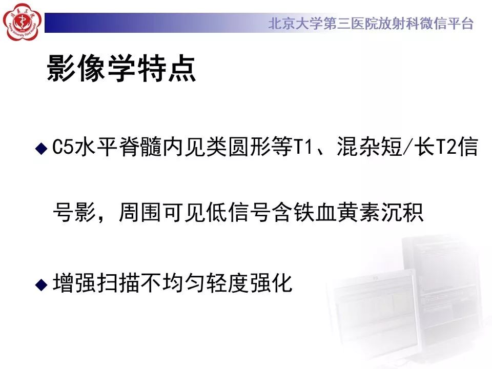 【PPT】椎管内海绵状血管瘤的影像