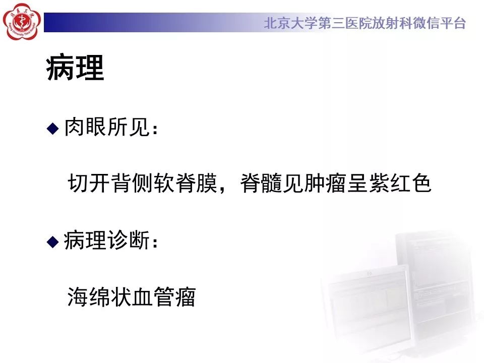 【PPT】椎管内海绵状血管瘤的影像