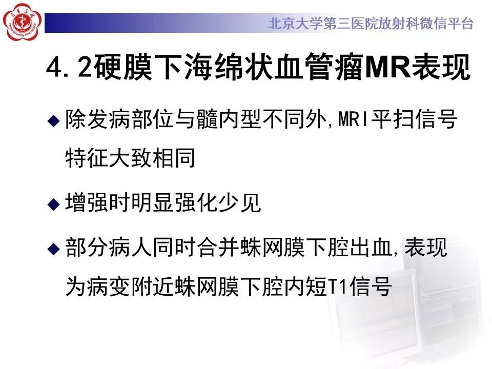【PPT】椎管内海绵状血管瘤的影像