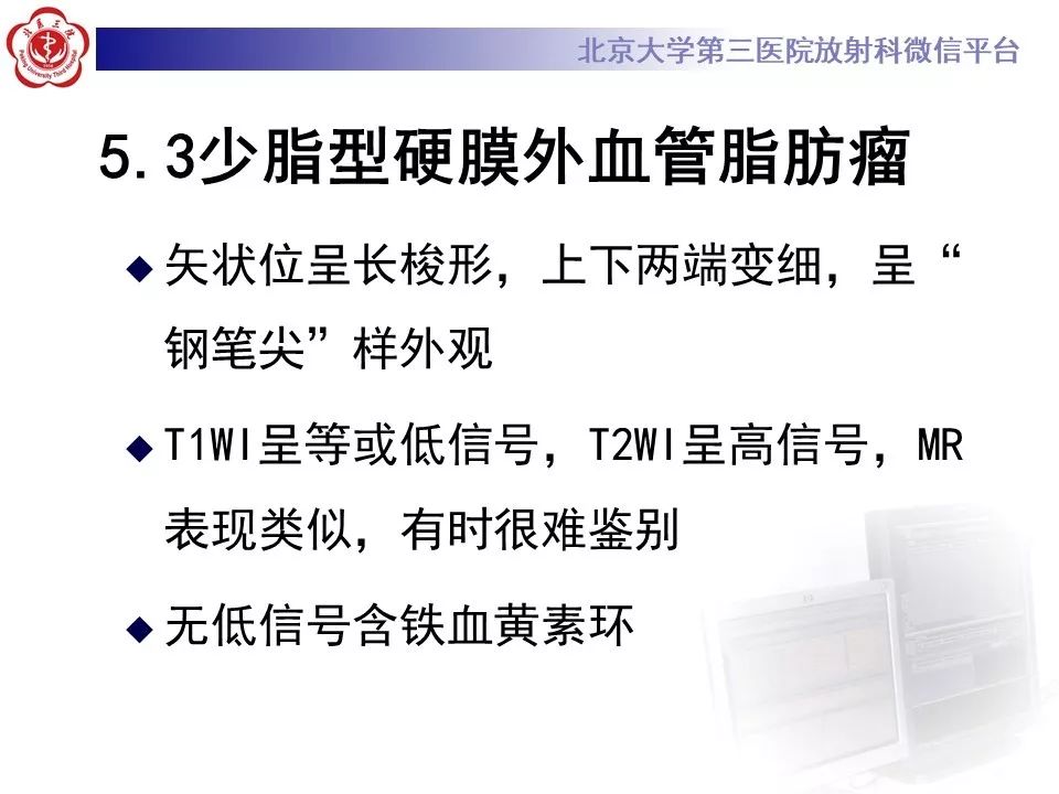 【PPT】椎管内海绵状血管瘤的影像