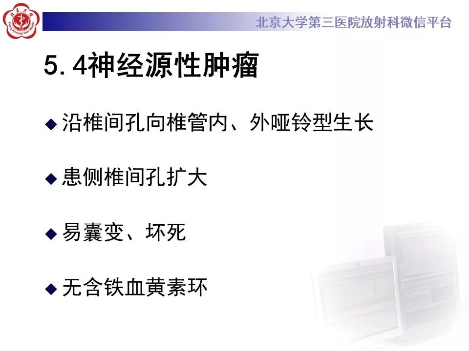 【PPT】椎管内海绵状血管瘤的影像