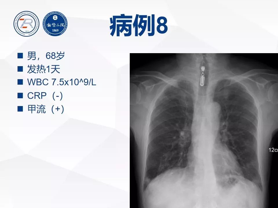 【PPT】新型冠状病毒肺炎早知道—胸片细节见真章（肺炎和病毒性肺炎X线诊断