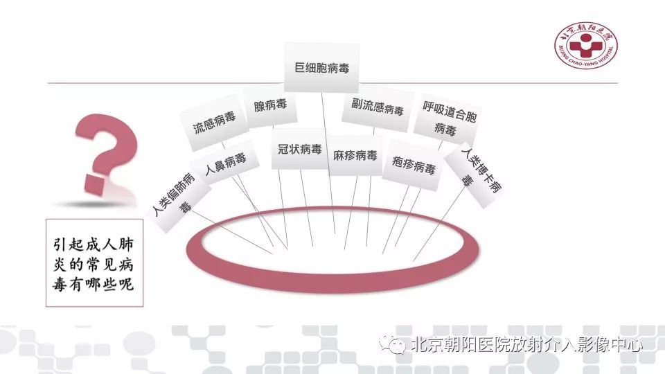 【PPT】病毒性肺炎影像诊断思路
