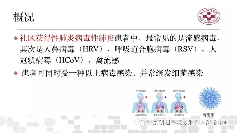 【PPT】病毒性肺炎影像诊断思路