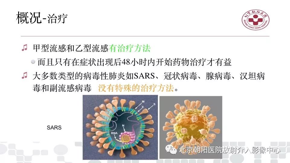 【PPT】病毒性肺炎影像诊断思路