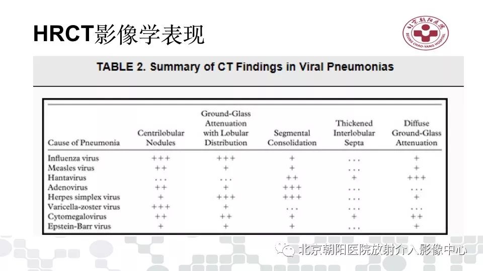 【PPT】病毒性肺炎影像诊断思路