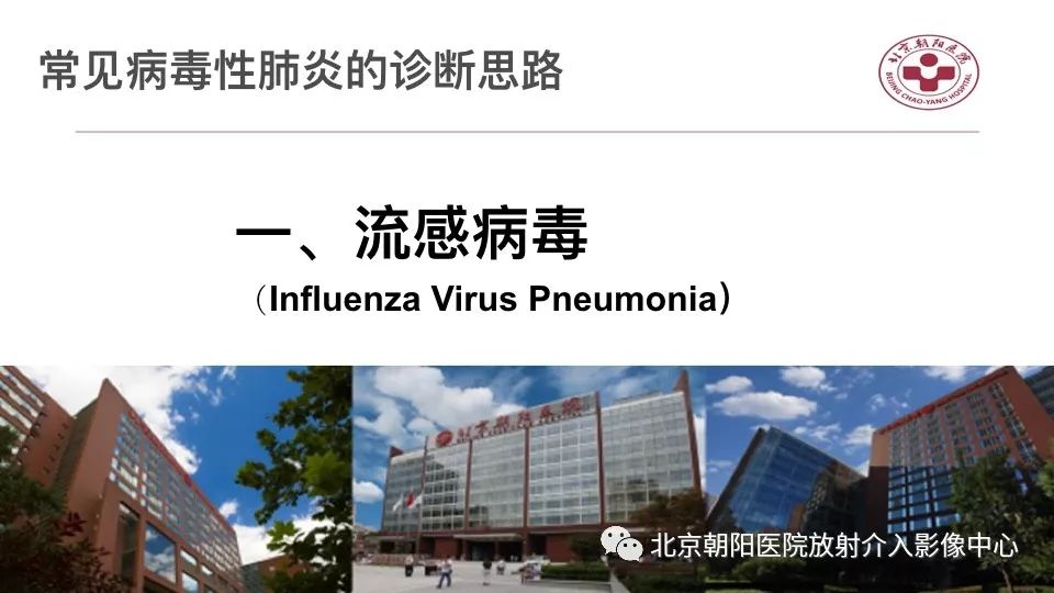 【PPT】病毒性肺炎影像诊断思路