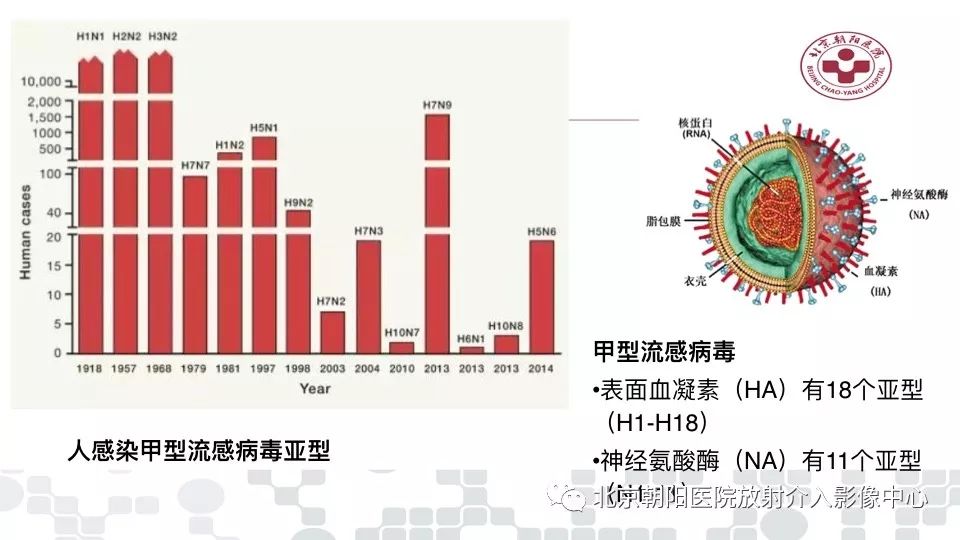【PPT】病毒性肺炎影像诊断思路