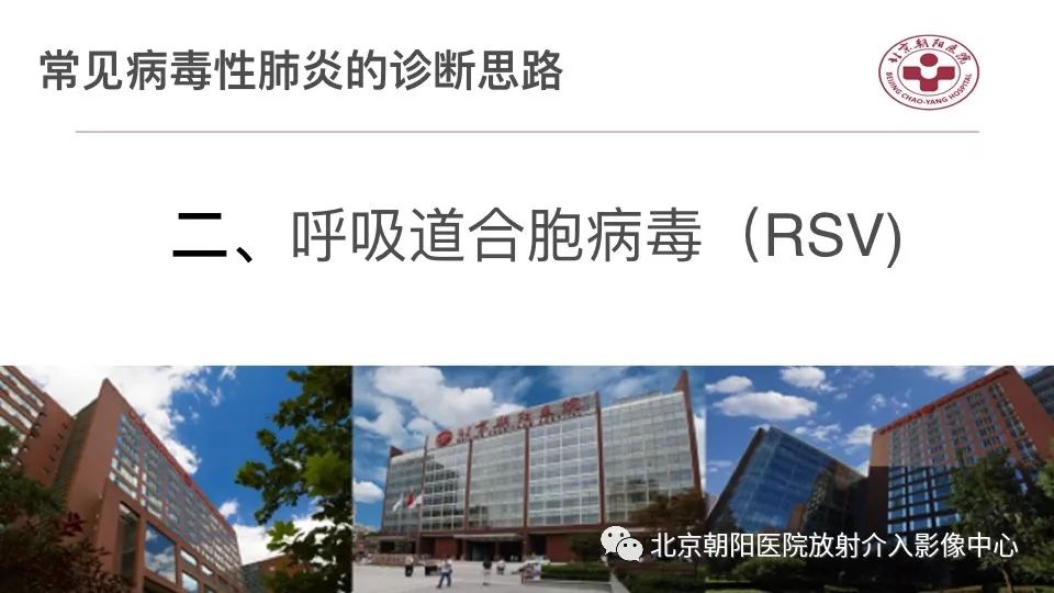 【PPT】病毒性肺炎影像诊断思路