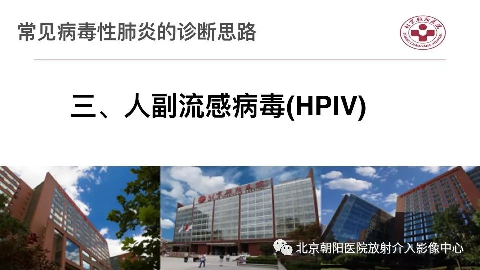 【PPT】病毒性肺炎影像诊断思路